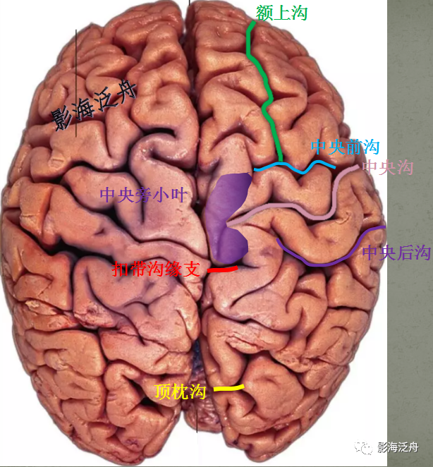 史上最详细的头颅mr解剖之额,顶,枕叶的脑沟,脑回定位_医学界-助力