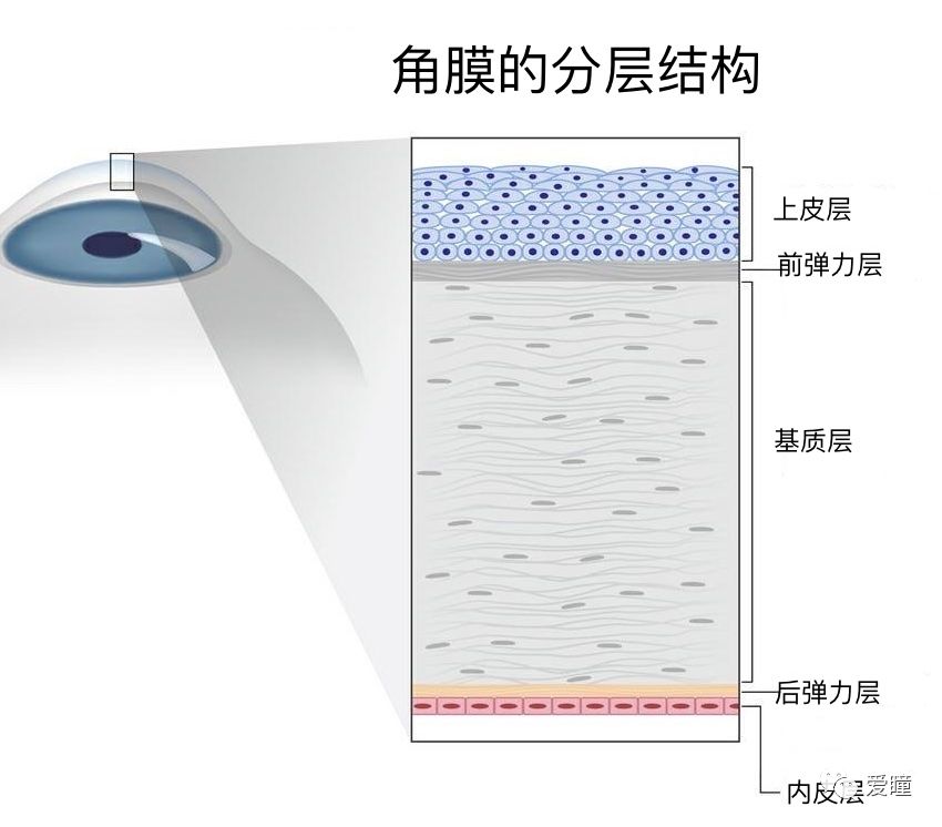 角膜的结构:从前往后依次是上皮层,前弹力层,基质层,后弹力层,内皮层