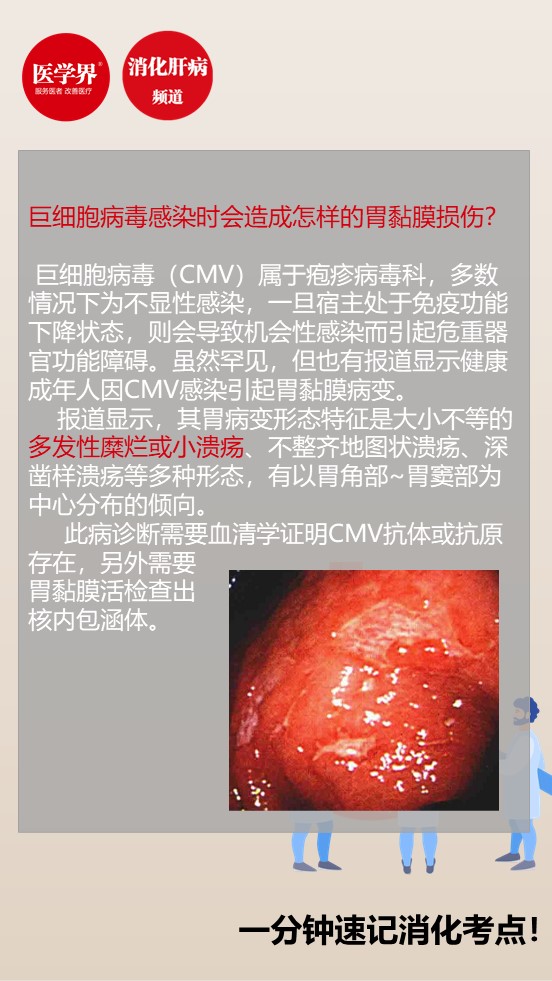 一分钟速记巨细胞病毒感染时会造成怎样的胃黏膜损伤