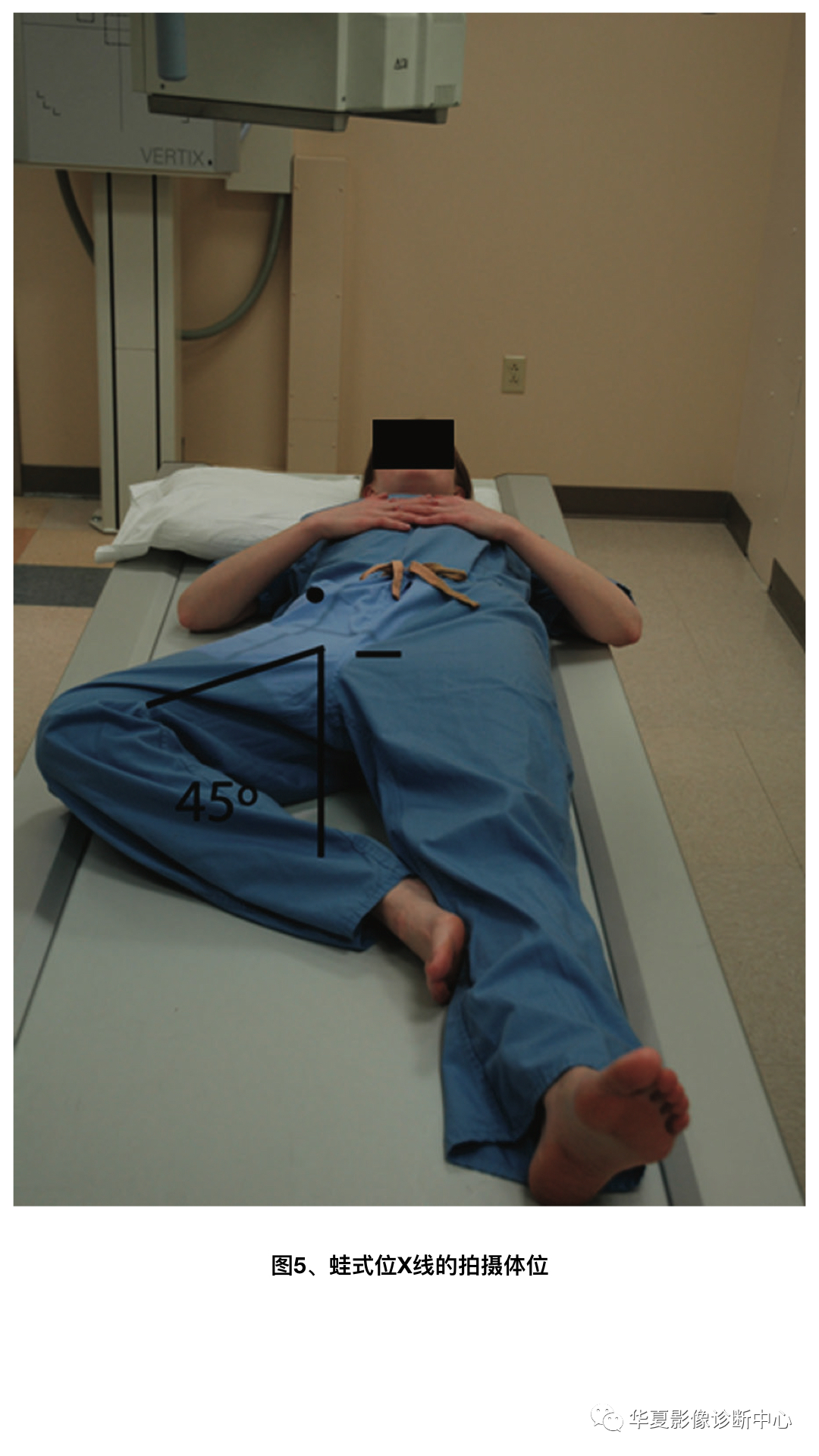 髋关节x线摄片技术指南_医学界-助力医生临床决策和职业成长