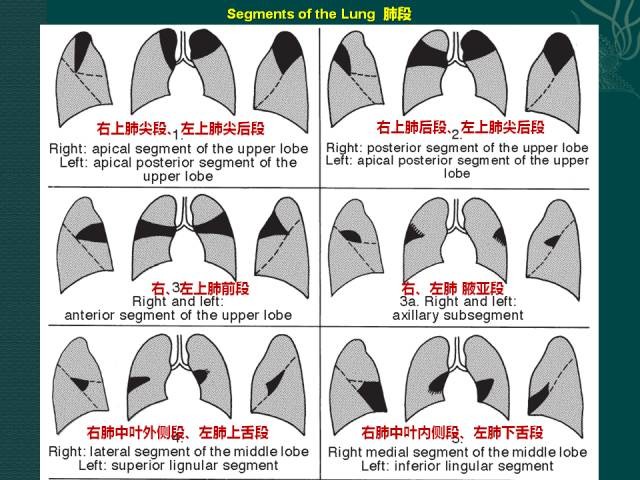 左肺小舌解剖图图片