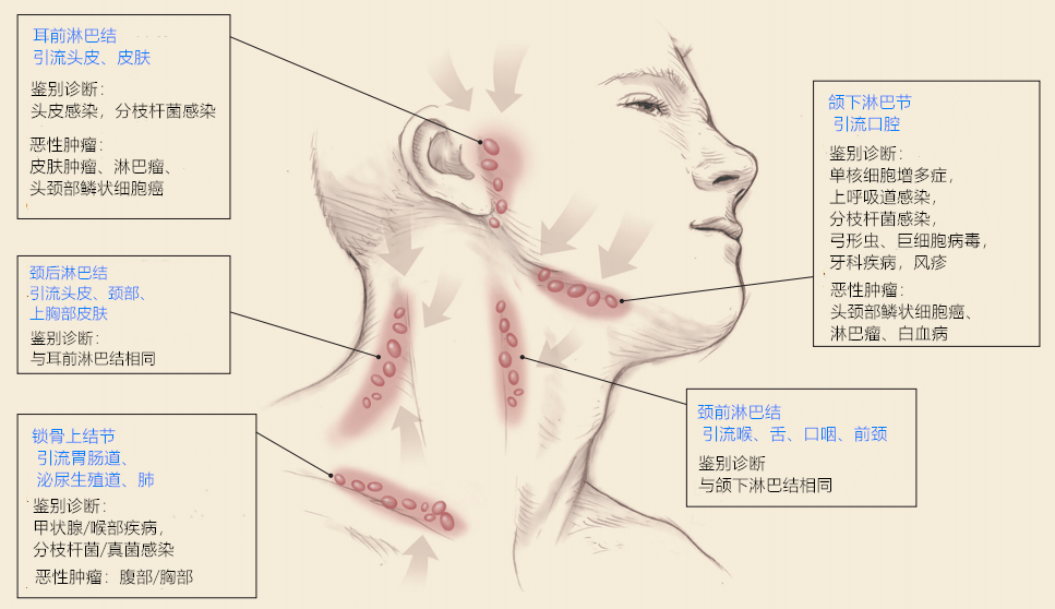 淋巴结肿大的病因