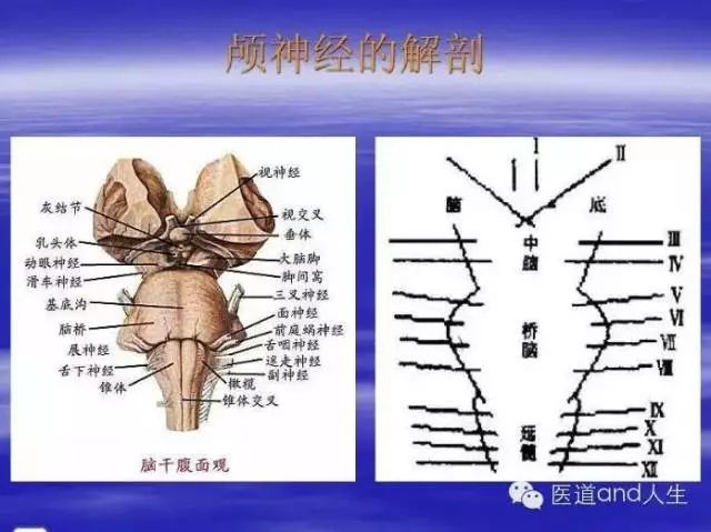 可收藏丨mri圖像中的八條顱神經