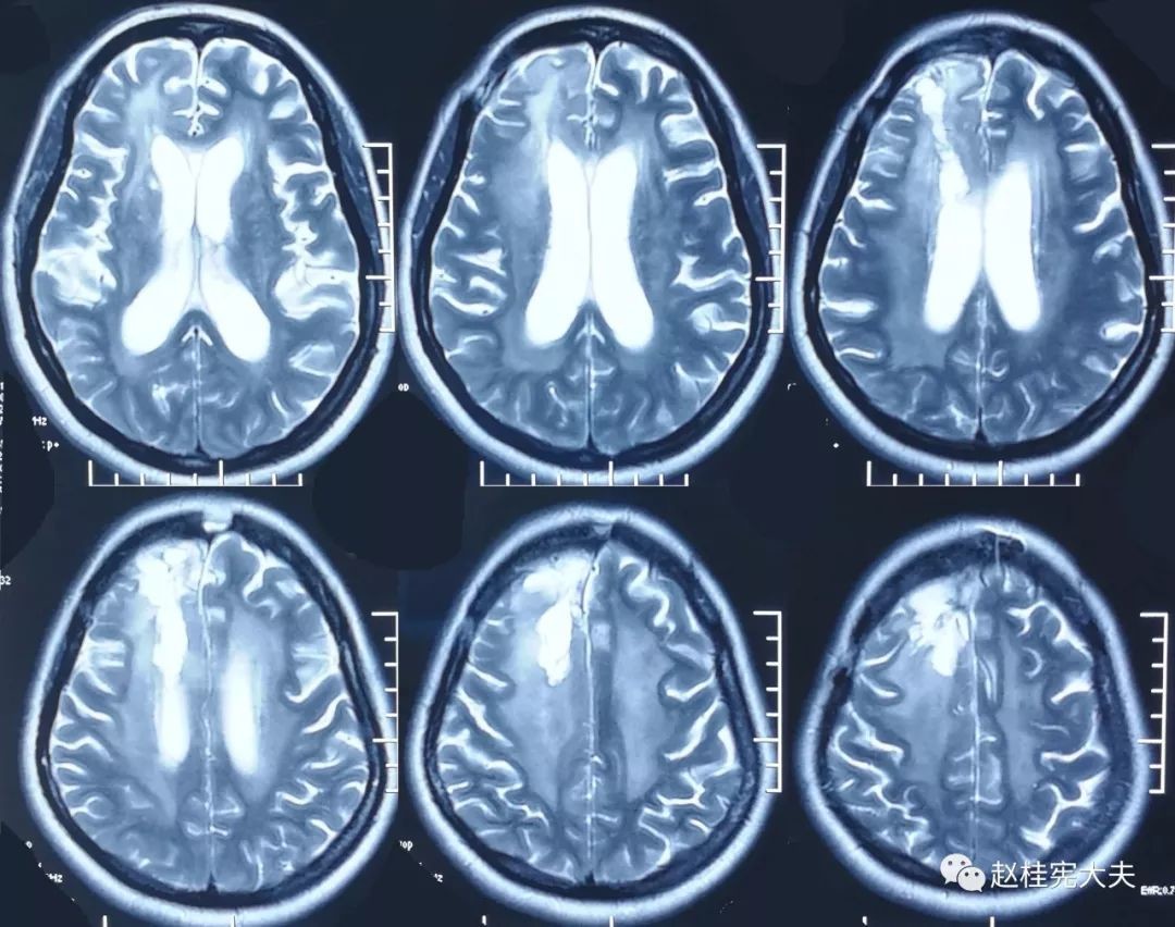 脑CT和脑磁共振有何区别？对人体有害吗 - 知乎