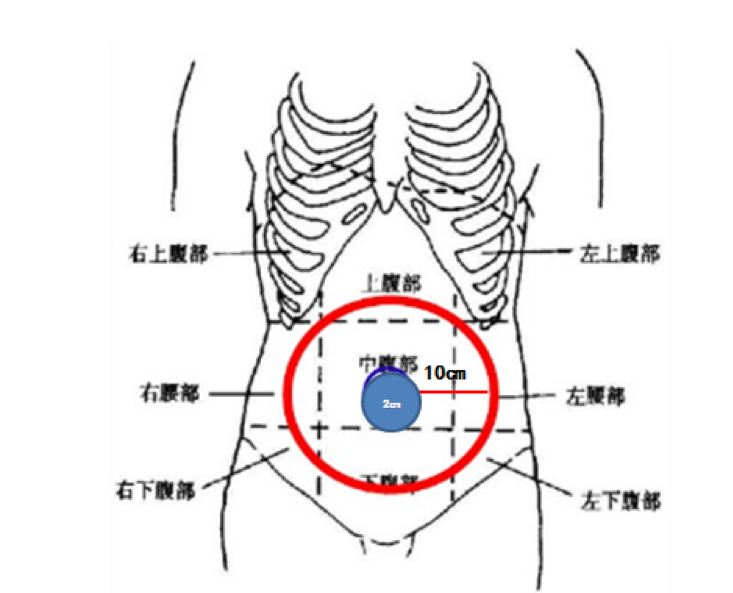 肝素钠打肚子的位置图图片