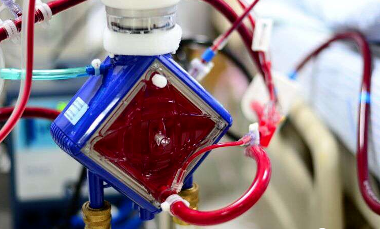 浅谈终极武器ecmo的插管两三事