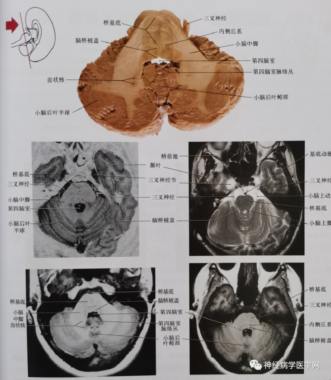 临床神经解剖图谱(断层影像 切片)