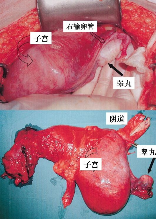 子宫外表图片