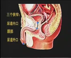 留置导尿技术操作流程 医学界 助力医生临床决策和职业成长