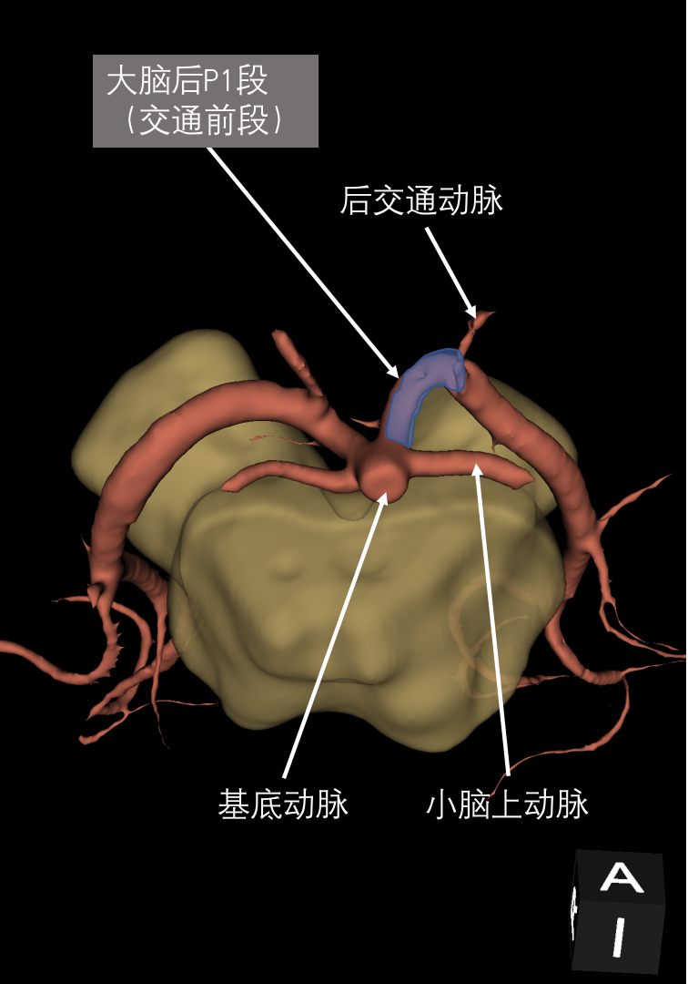 腦血管系統影像解剖學3d模式呈現下篇