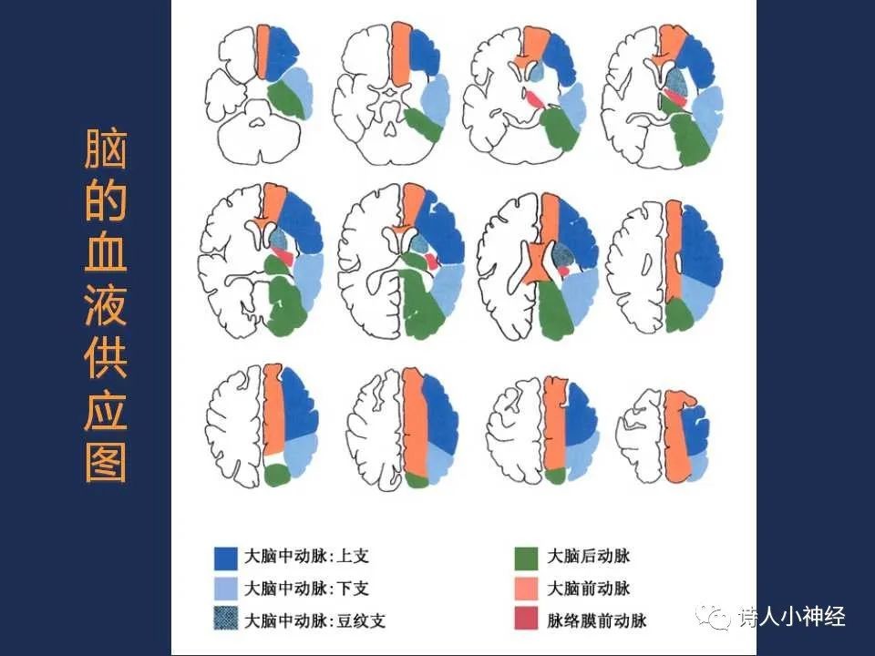 从脑梗死部位推测责任血管超全总结