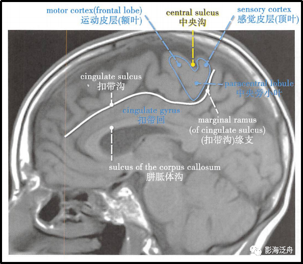 史上最详细的头颅MR解剖之额、顶、枕叶的脑沟、脑回定位_医学界-助力医生临床决策和职业成长