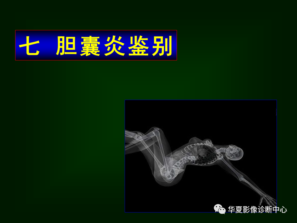 胆囊炎影像诊断