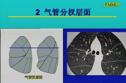 前面我们学习肺段的解剖位置,肺段在支气管