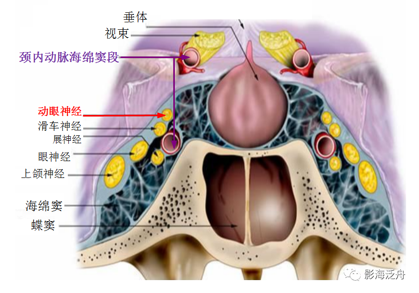 枕窦解剖图图片