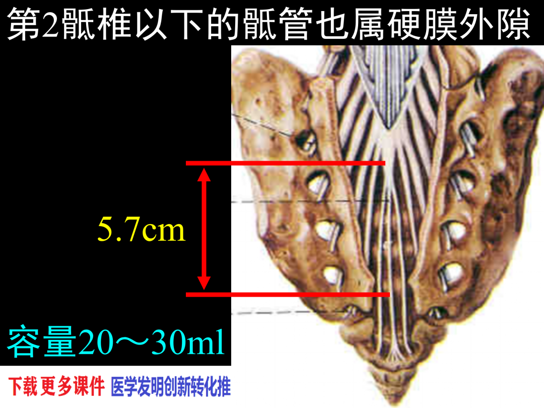 骶管解剖图片