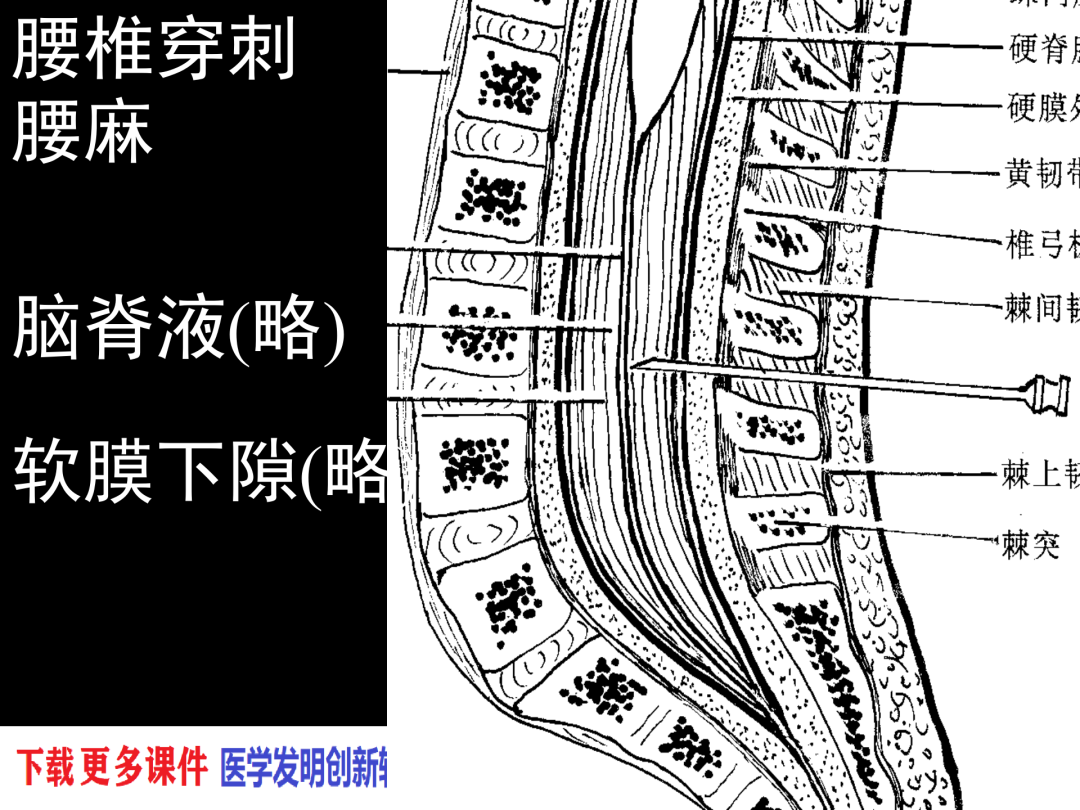 椎管结构横截面图图片