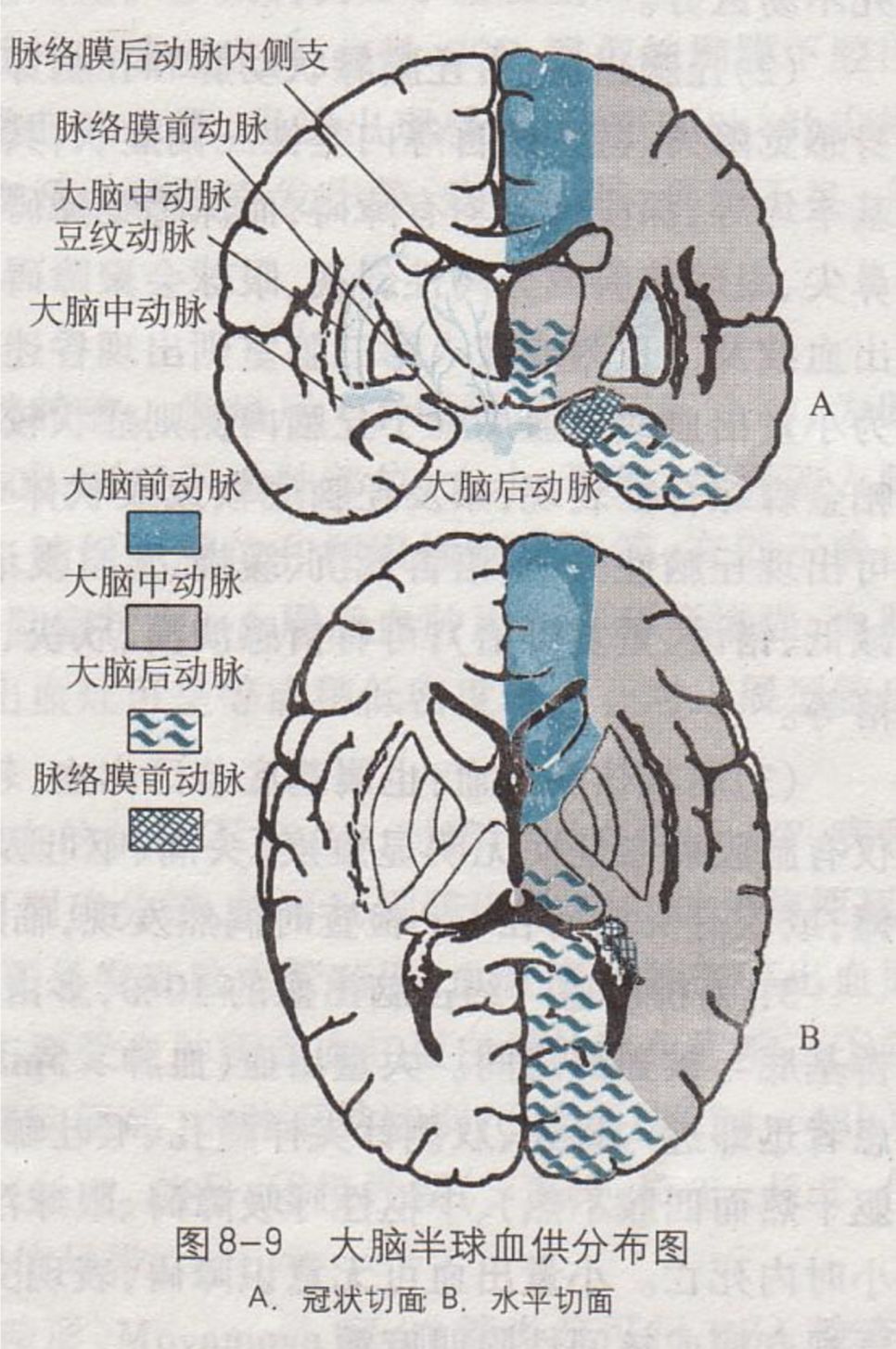 不同脑部位出血表现,值得收藏
