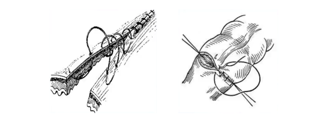 缝合手法大盘点