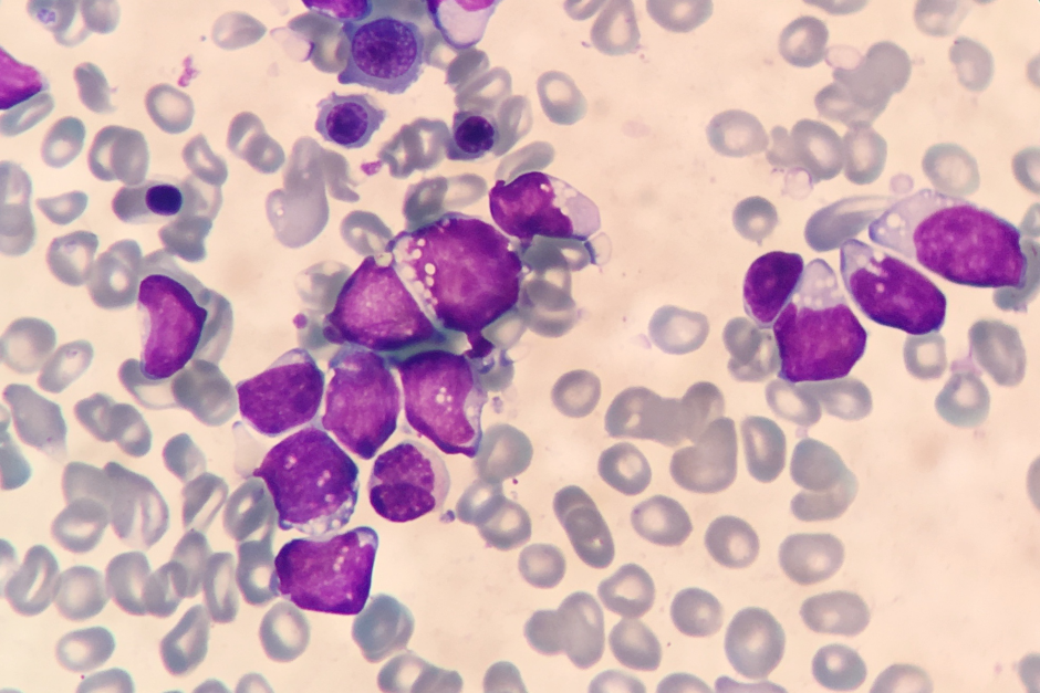 圆或类圆形,胞浆少见,淡蓝色,有些为深蓝色;部分细胞胞浆内可见空泡