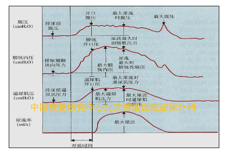 尿动力学基础(三)_医学界-助力医生临床决策和职业成长