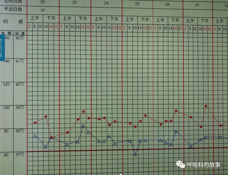 教你学会看体温单如何抓住关键信息