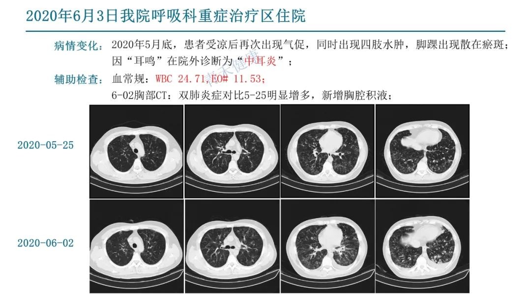 脉管阳性图片