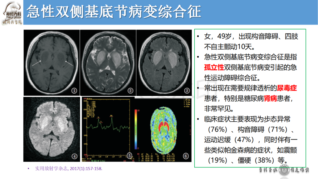 最全基底节区病变影像及诊断