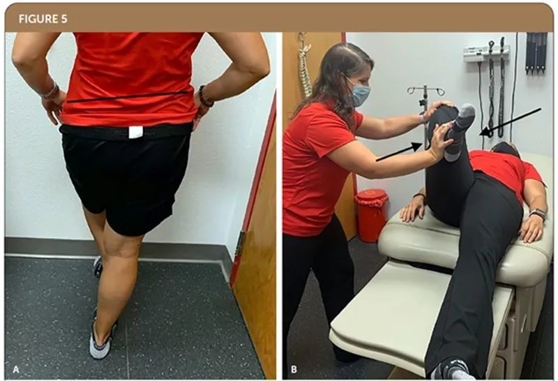 (a)改良trendelenburg试验.