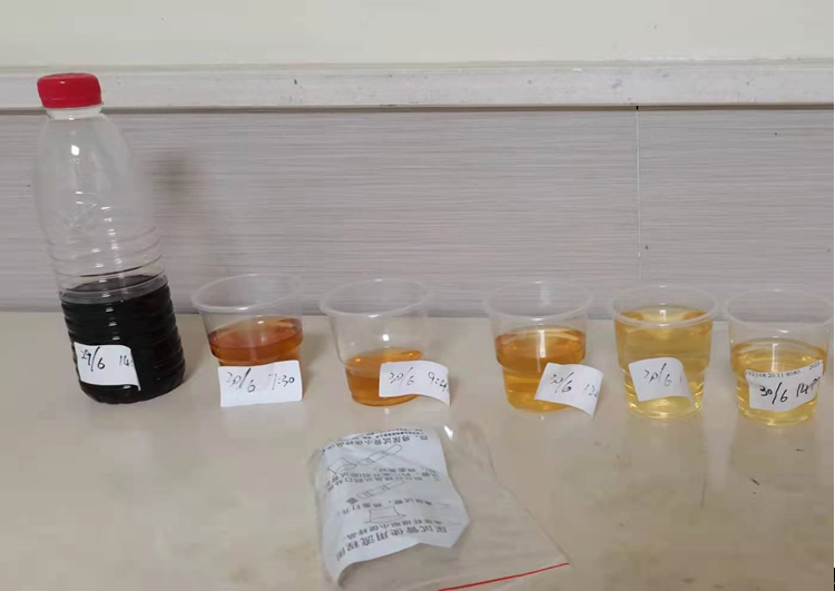 一包蚕豆吃进医院尿液出现酱油色