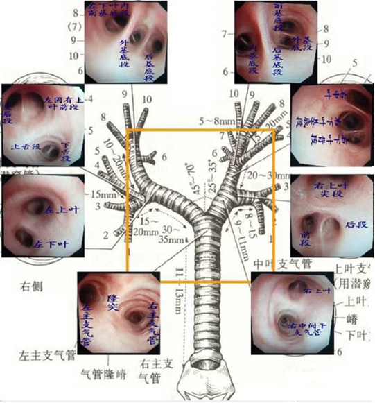 纤维支气管镜解剖图谱图片