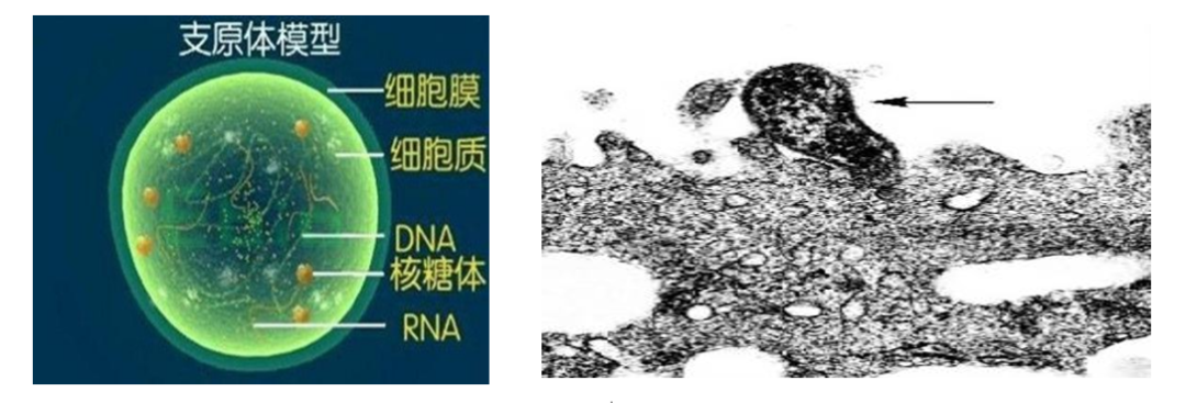 速戳,手把手教你诊治成人支原体肺炎_医学界-助力医生临床决策和职业
