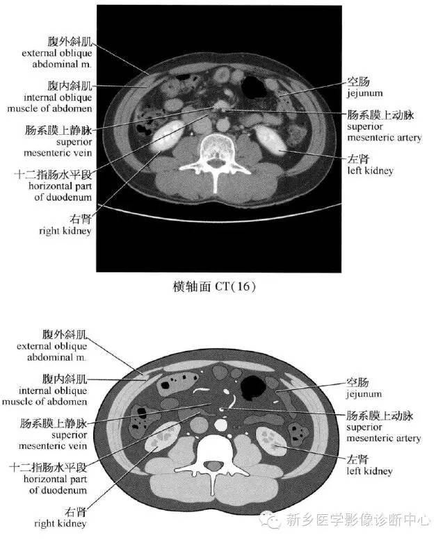 腹部横断位解剖 详细标注