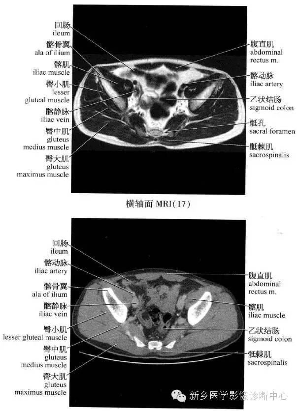 腹部横断位解剖 详细标注