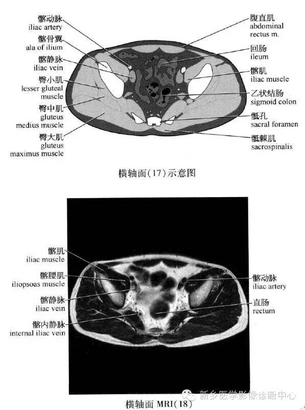 腹部横断位解剖 详细标注