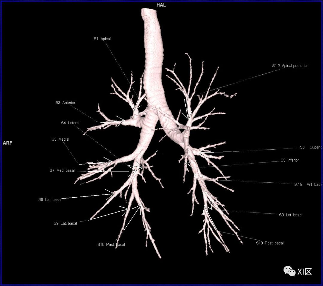 超詳細的肺部影像解剖圖譜_醫學界-助力醫生臨床決策和職業成長