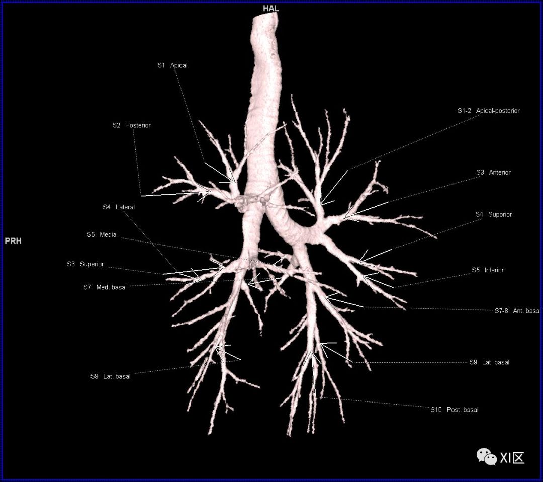 段支氣管的命名氣管樹的動態觀察視頻:肺的分段肺的分段示意圖(圖片源
