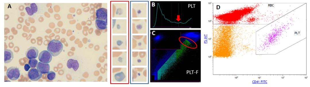 警惕这种少见碎片会干扰血小板计数