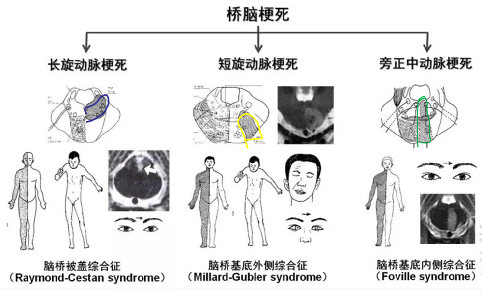 颅脑解剖基础第二期医生必备