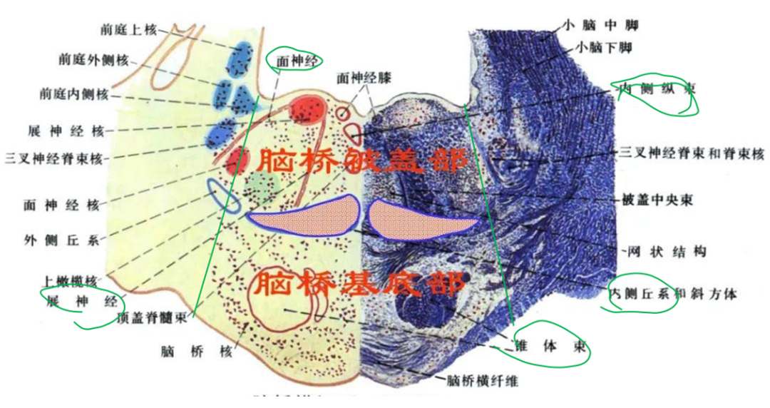 内侧纵束解剖图图片