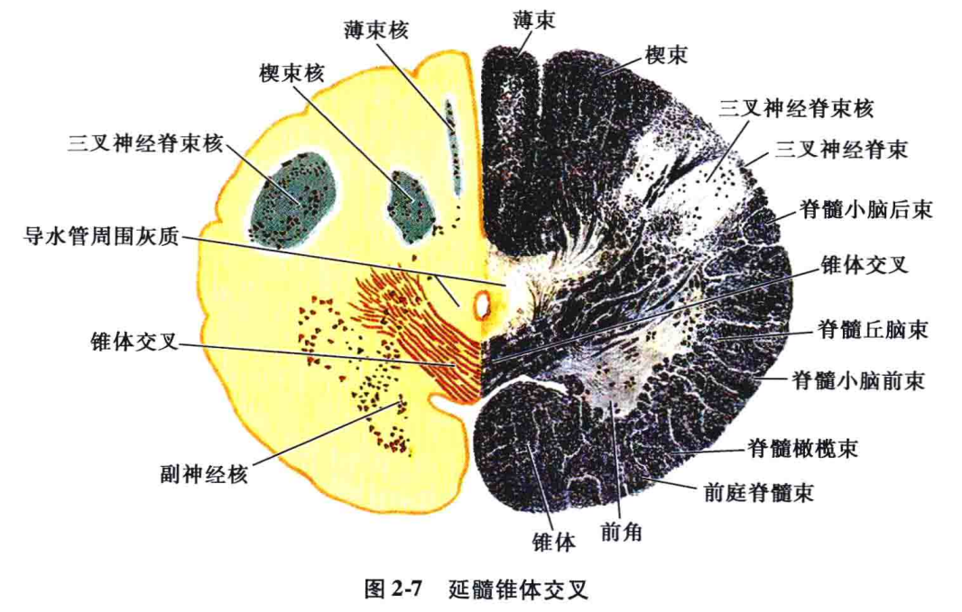 延髓腹侧面图片