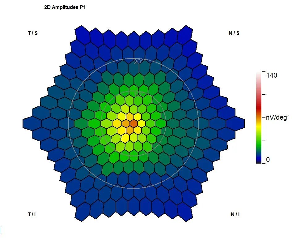多焦视网膜电图在眼外伤患者中的应用_医学界-助力医生临床决策和职业