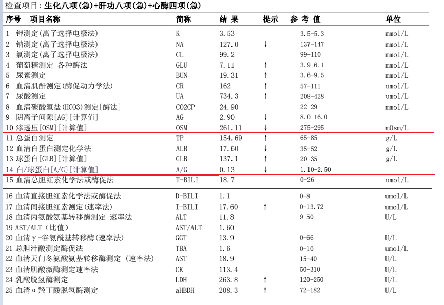 狡猾多变的m蛋白 从高球蛋白血症到多发性骨髓瘤 医学界 助力医生临床决策和职业成长