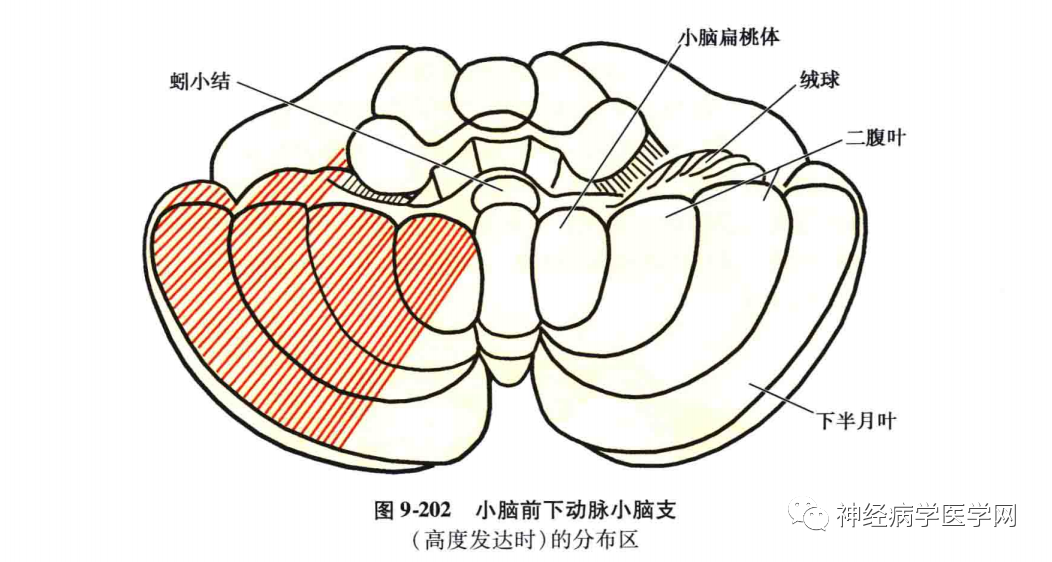 小腦中腳和小腦前下方(包括絨球)