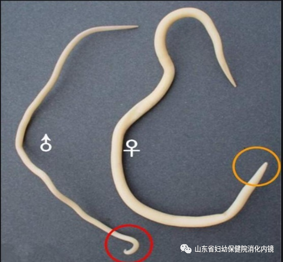 60岁老人腹痛贫血,肠镜检查发现肠腔有虫体蠕动