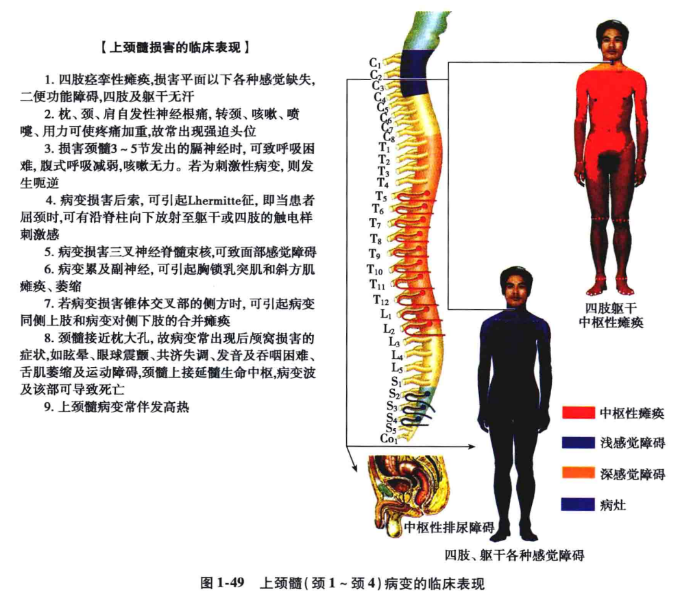 中枢神经系统疾病定位诊断图解