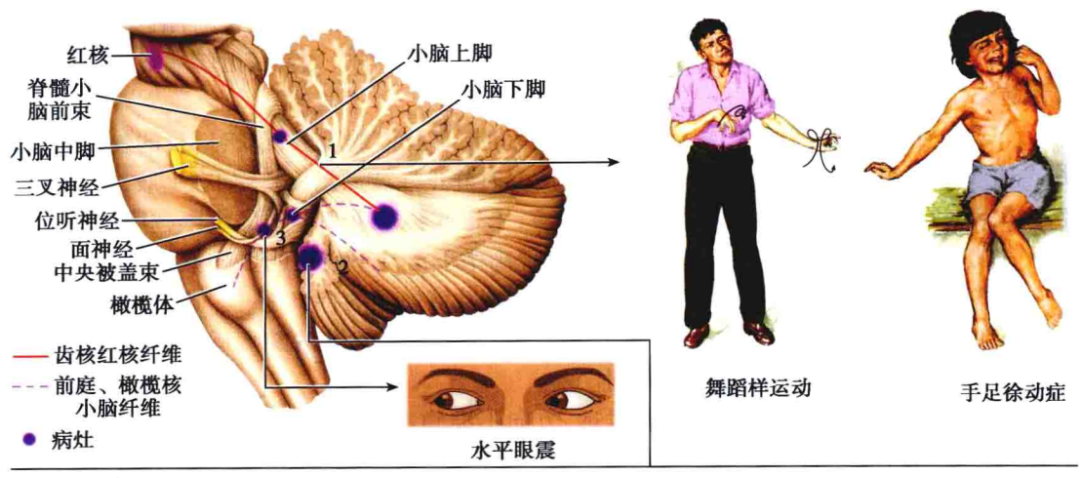 小脑上中下脚解剖图图片