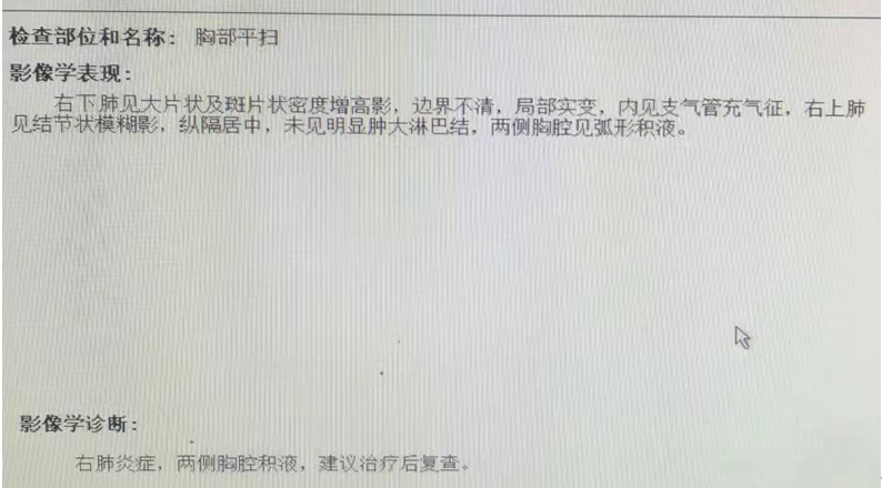 兄弟俩相继诊断为「肺炎」,老三又发热了,怎么回事?