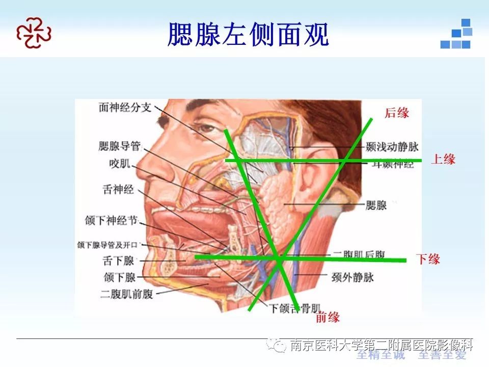 腮腺腺淋巴瘤的影像学表现