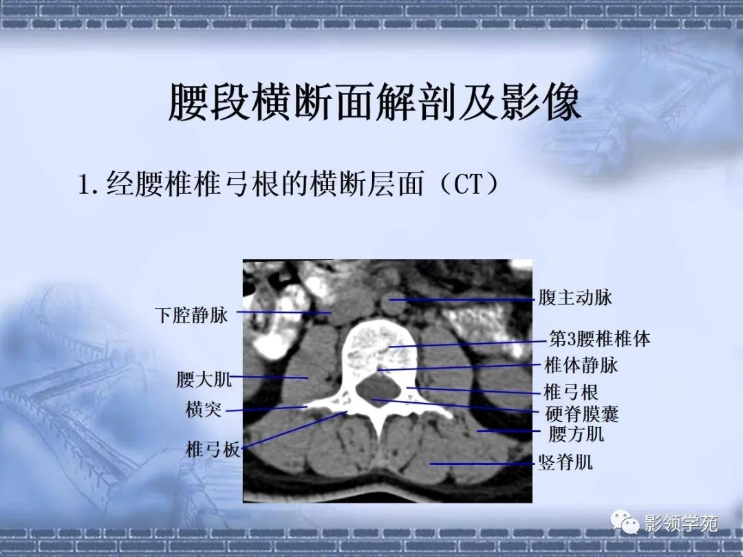 一文总结颈椎腰椎ct常见病变